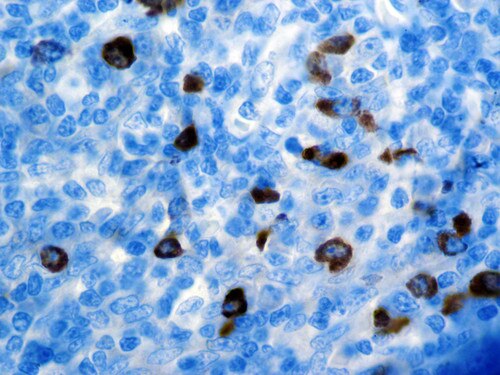 IHC of Lambda on an FFPE Tonsil Tissue